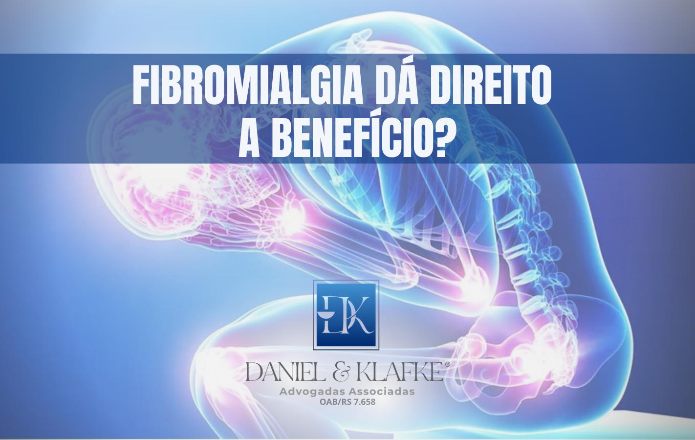 Leia mais sobre o artigo Fibromialgia dá direito a benefício? Entenda a nova lei nº 15.176/2025 e o que mudou: